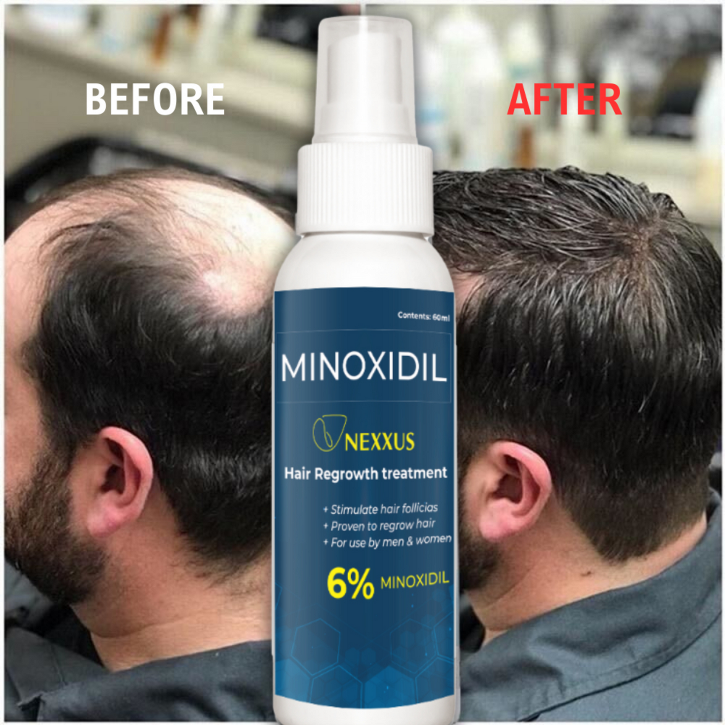 NEXXUS MINOXIDIL HAIR SPRAY (AUTHENTIC)