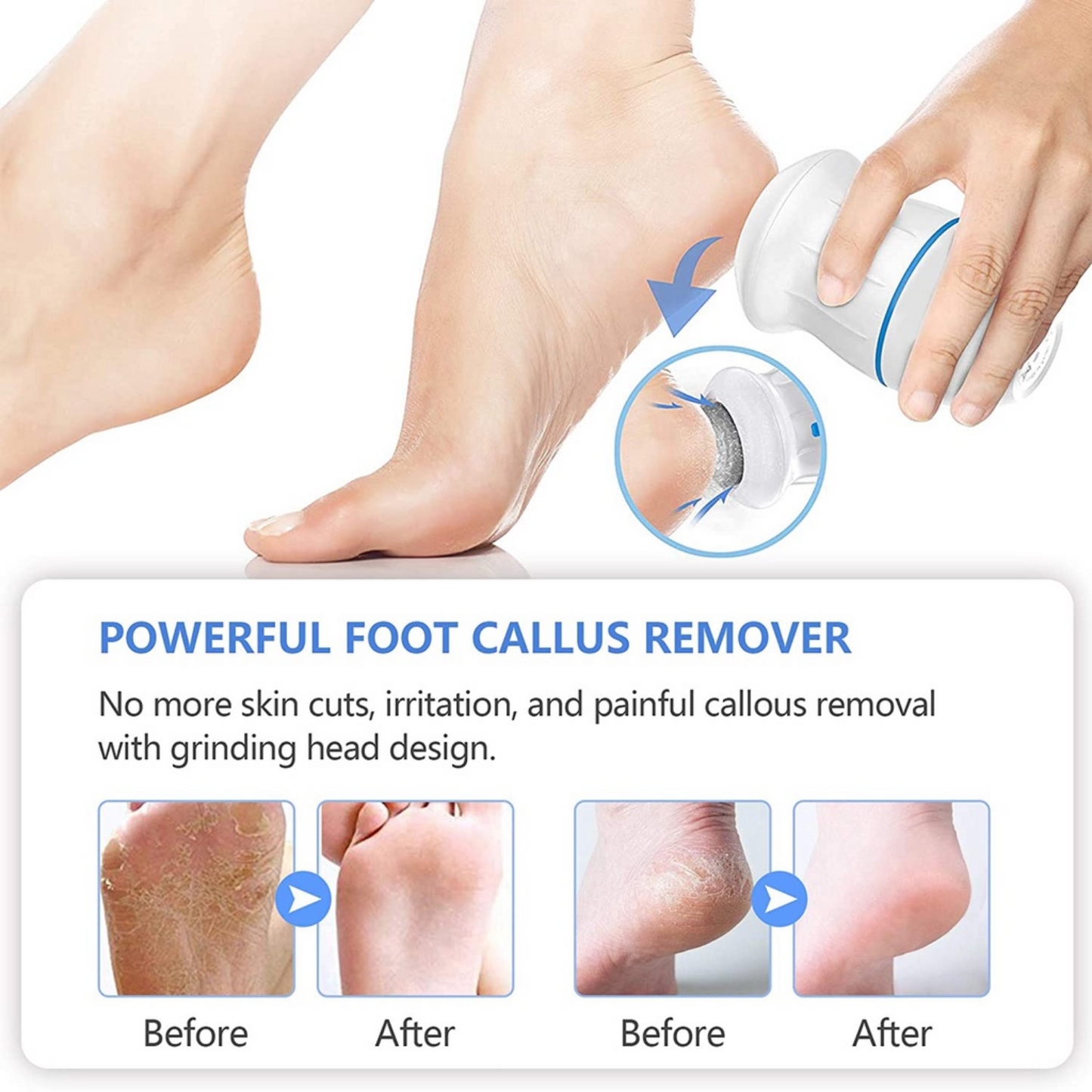 ELECTRIC FOOT CALLUS REMOVER (JAPAN MADE - HIGH QUALITY)