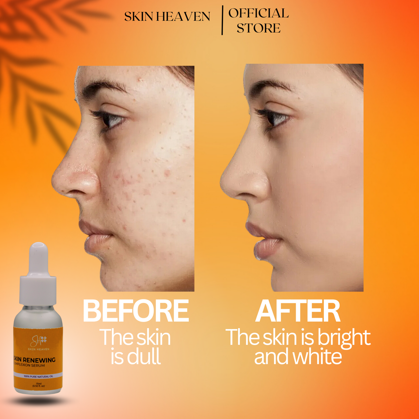 SKIN HEAVEN - Renewing Serum & Whitening Soap