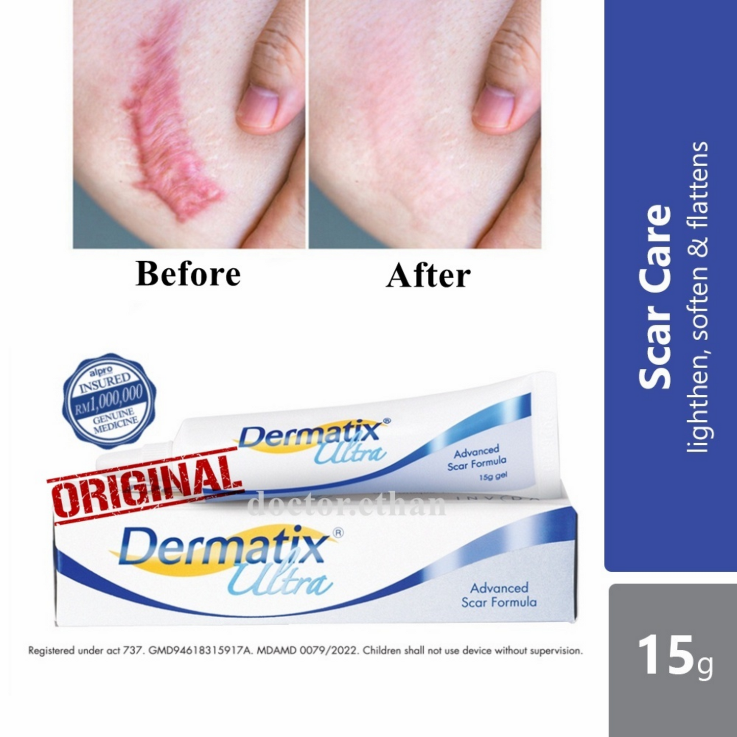 DERMATIX ULTRA - ADVANCE SCAR REMOVAL GEL