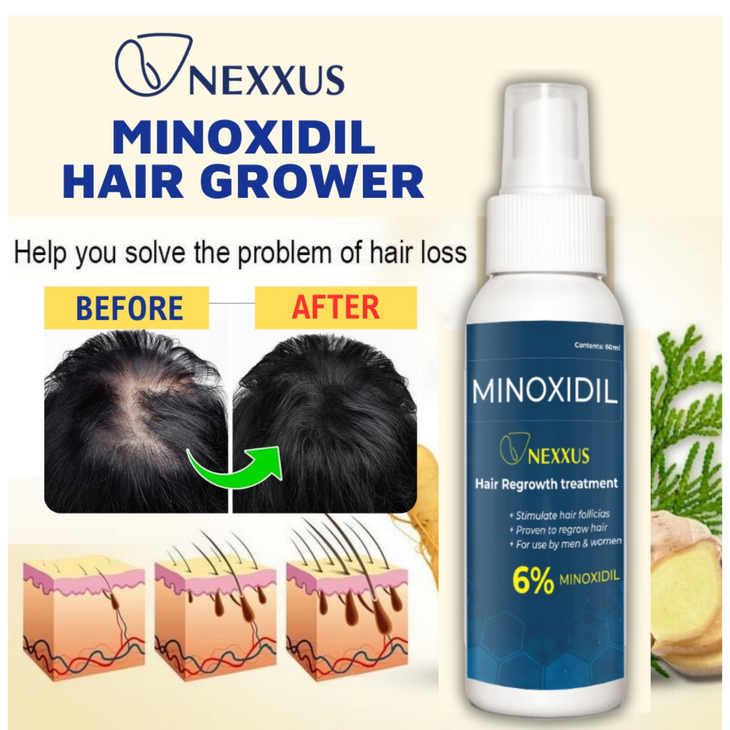 NEXXUS MINOXIDIL HAIR SPRAY (AUTHENTIC)