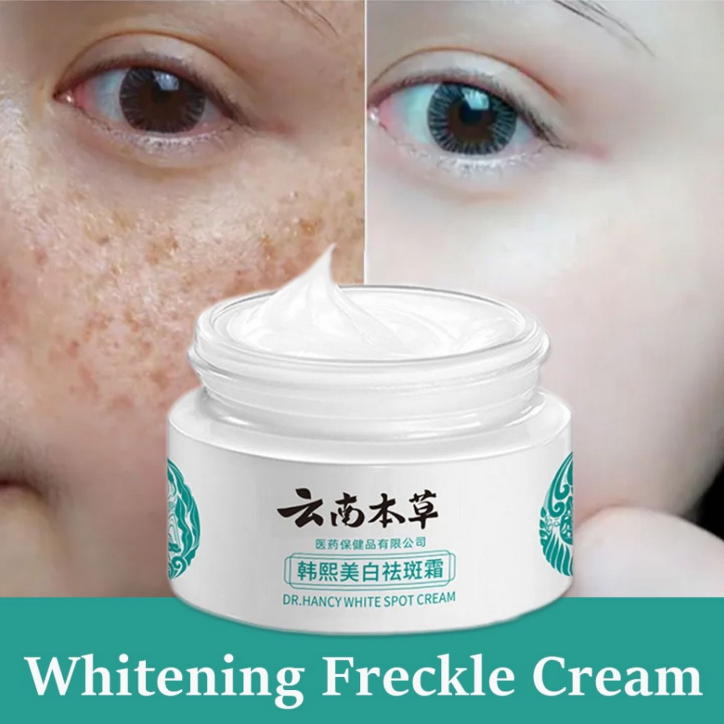 DR. NANCY - JAPANESE MELASMA CREAM (AUTHENTIC)