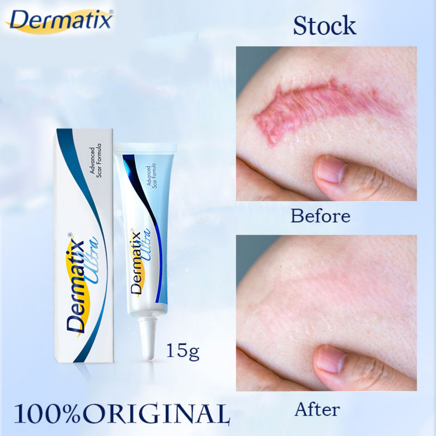 DERMATIX ULTRA - ADVANCE SCAR REMOVAL GEL