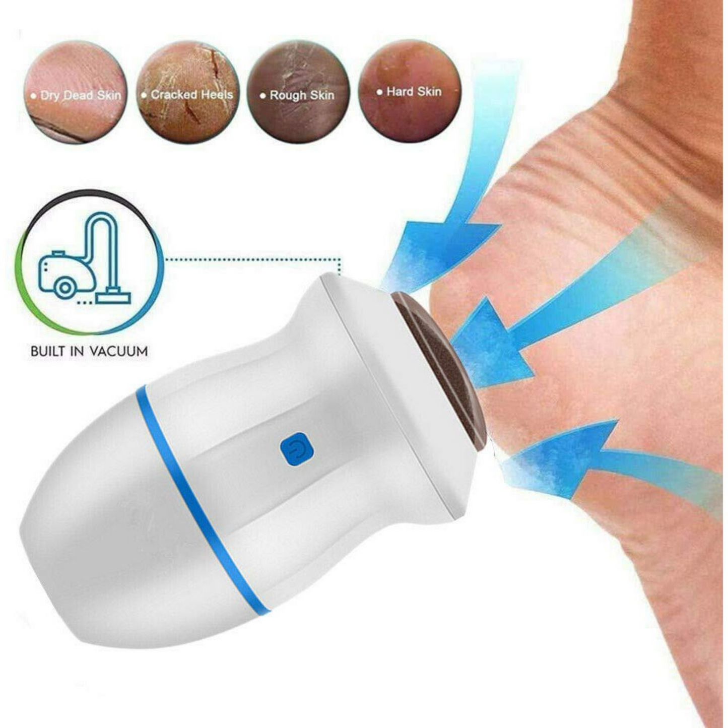 ELECTRIC FOOT CALLUS REMOVER (JAPAN MADE - HIGH QUALITY)