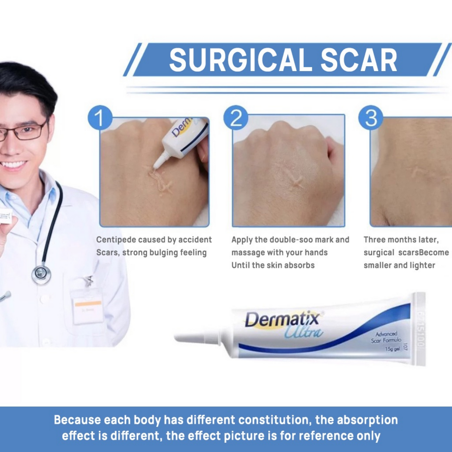 DERMATIX ULTRA - ADVANCE SCAR REMOVAL GEL