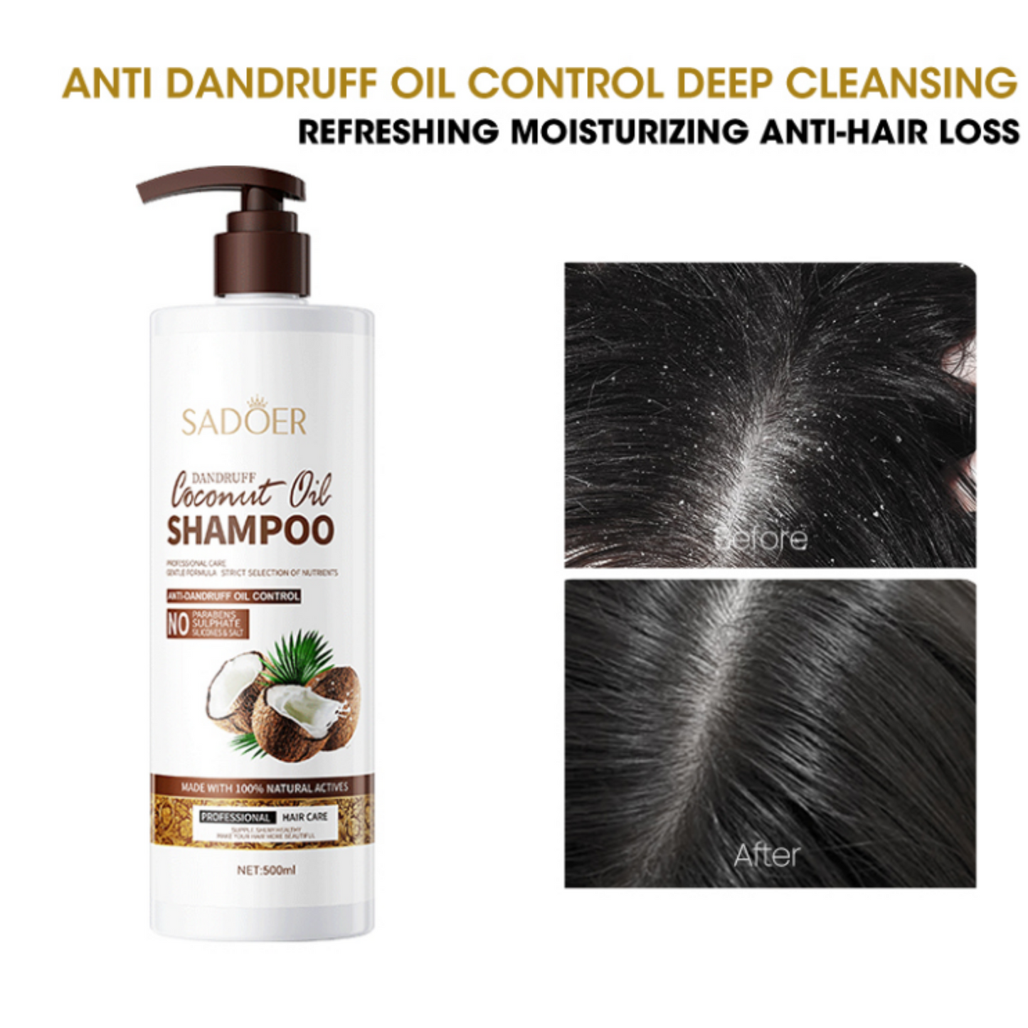 SADOER COCONUT SHAMPOO (AUTHENTIC)